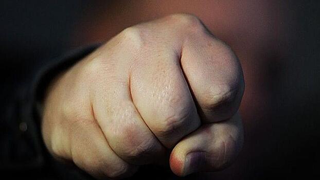 Сломал челюсть, не желая уступать такси, мужчина в Нюксенице