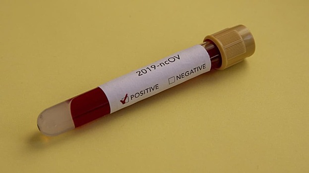В Ростовской области коронавирус за сутки обнаружен у 241 человека