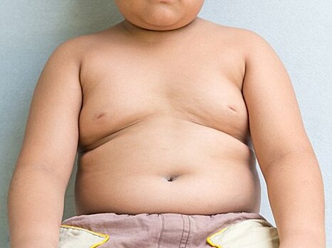 Детей с ожирением нужно чаще отправлять к хирургам