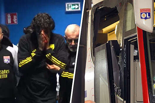 Тренеру "Лиона" Гроссо наложили 15 швов после нападения на автобус команды