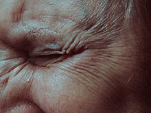 Врач рассказала о факторах, способствующих быстрому старению