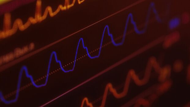 Ученые представили ультратонкий кардиостимулятор, работающий от света