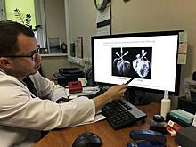 Кардиологи ГКБ №13 предложат программу тренировок пациентам, перенесшим инфаркт миокарда