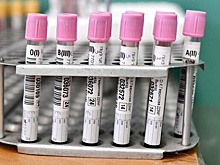 В Москве выявлено 7 897 новых случаев COVID-19