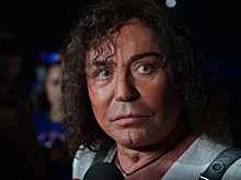 «Может получить неровное лицо или потерю мимики»: что грозит увлекшемуся пластикой Валерию Леонтьеву