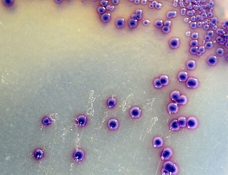 Небольшая спираль мембранного белка оказалась важна для запуска иммунного ответа