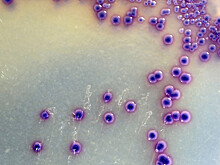 Небольшая спираль мембранного белка оказалась важна для запуска иммунного ответа