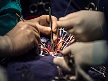 В Индии была проведена успешная бескровная операция на открытом сердце