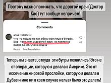 Виктория Боня продемонстрировала последствия неудачной пластики лица: «У меня никогда такого не было»