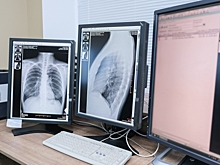 Врач Курбанова рассказала о связи рентгена и возникновения рака