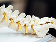 Разработано приложение, диагностирующее сколиоз с помощью смартфона