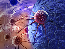 Названа причина 90% онкологических заболеваний