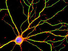 Мозг в десять раз более активен, чем считалось прежде