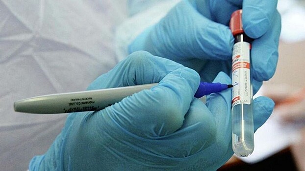 У 176 вологжан выявили коронавирус на прошлой неделе