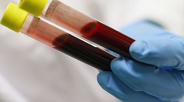 Ученые рассказали об особенностях каждой группы крови