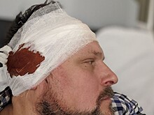 Разоблачавший мошенников экс-главред журнала «Финанс» избит в Москве