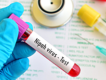 Иммунолог рассказал, опасна ли вспышка вируса Нипах в Индии