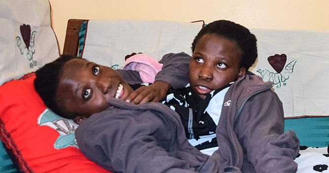 В Танзании умерли популярные сиамские близнецы