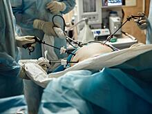 В ОКБ спасли от холецистита беременную седьмым ребёнком