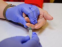 Диетолог сообщил, что нужно сделать перед началом похудения