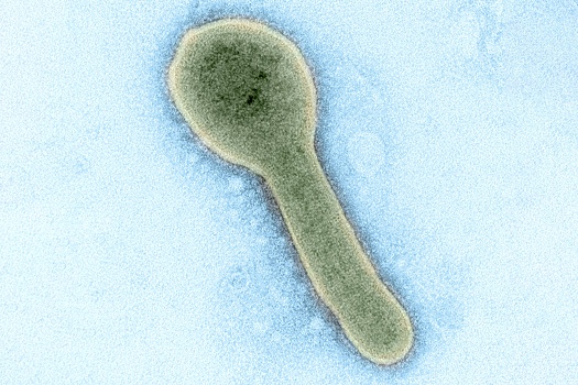 Роспотребнадзор: Сообщения о лихорадке Марбург в Эфиопии находятся на контроле