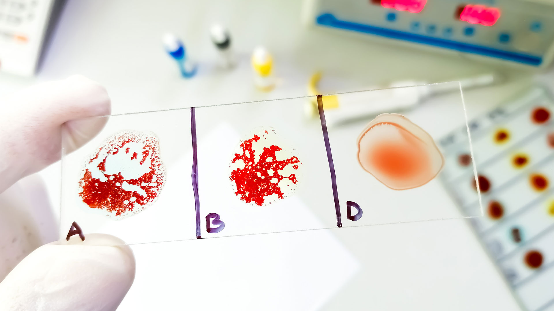 Выявлена ​​группа крови, которая приносит наибольшую пользу для здоровья