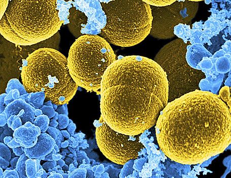 Золотистый стафилококк способен вызывать зуд напрямую