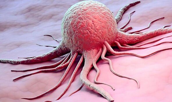Ученые научились предсказывать риск превращения здоровых клеток в раковые