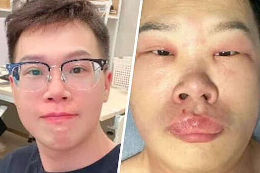 The Thaiger: китаец слишком часто ковырялся в носу и занес инфекцию