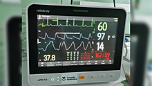 Надымская больница получила современные мониторы отслеживания состояния пациента