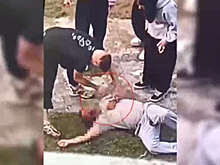 В Выборге юноша жестоко избил мужчину ради кражи наручных часов