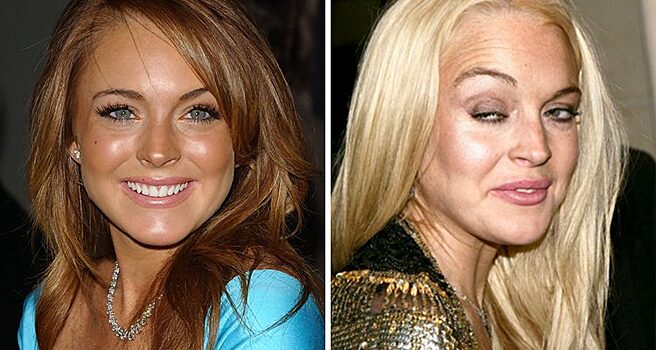 «До и после»: 5 фото знаменитостей, которые потеряли свою красоту