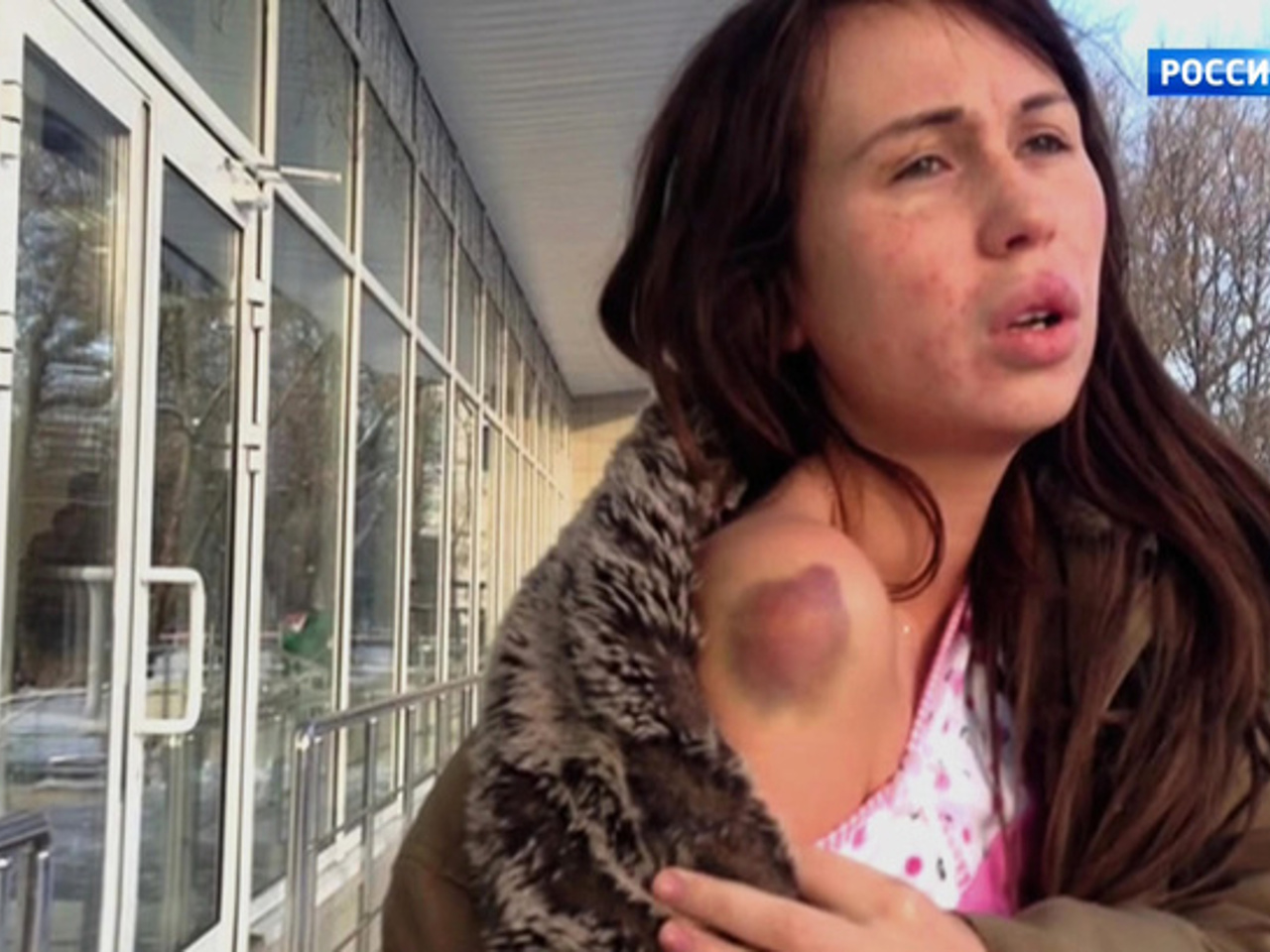 Лесби төбелес туралы бейнелер