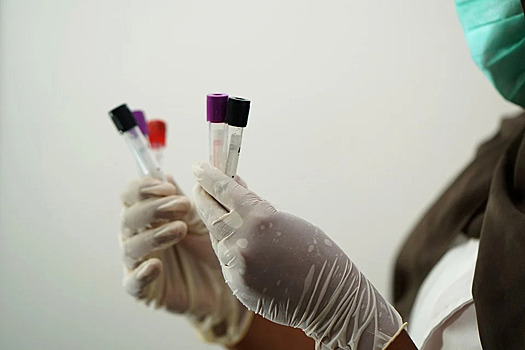 В Пензе за сутки выявили 103 случая коронавируса