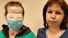 Пришили язык, собрали челюсть: красноярские врачи вернули девушке лицо
