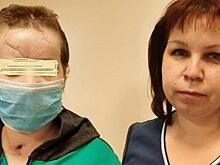 Пришили язык, собрали челюсть: красноярские врачи вернули девушке лицо