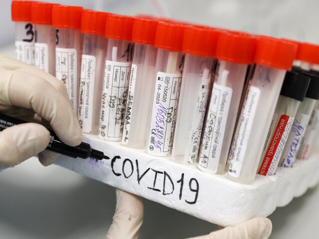 В Москве выявили 1 420 новых случаев коронавируса за сутки