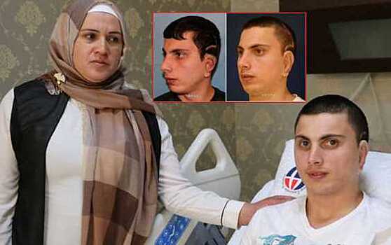 Врачи создали пациенту ушную раковину из ребра его матери