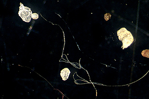 Микропластик меняет микрофлору кишечника: вызывает рак и депрессию