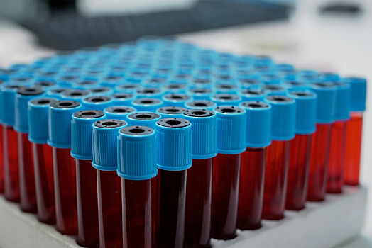 Какие анализы следует сдавать людям после 35 лет