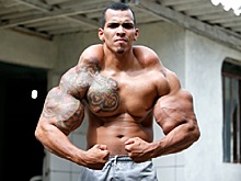 Бразильского бодибилдера спасли от ампутации рук