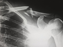 Ученые планируют сделать МРТ мумии соплеменника принцессы Укока