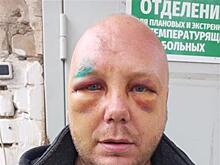 В Самарской области избили главу села и его товарищей