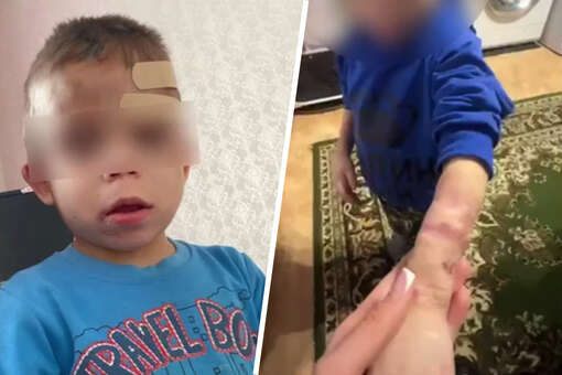 Избитого и истощенного мальчика с годовалой сестрой нашли в российской квартире