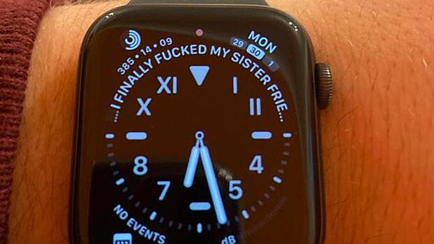 Apple Watch «спалили» своего владельца. Гаджет раскрыл всем пикантную тайну мужчины
