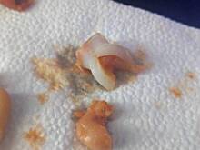 Зуб нашли в печеной фасоли из «Магнита» в Подмосковье