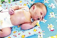 У новорождённой пермячки Алёны Ковиной диагностировали разрыв лёгкого