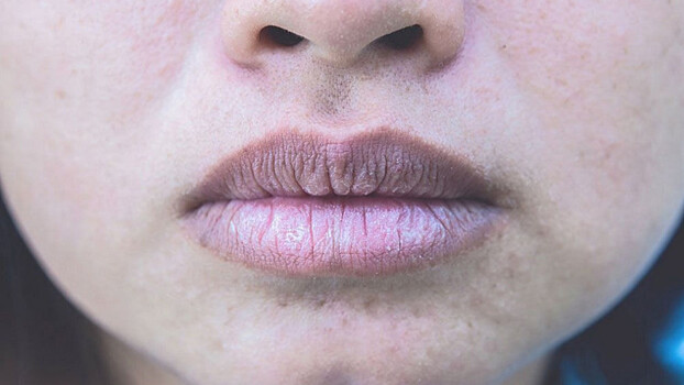 The Mirror: серые губы, кожа и ногти могут указывать на заражение «омикрон»-штаммом коронавируса