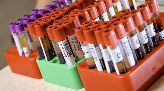 Первый в мире анализ крови на аутизм создается учеными