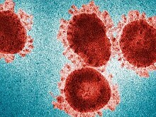 Главврач Калужского центра инфекционных заболеваний заразилась коронавирусом